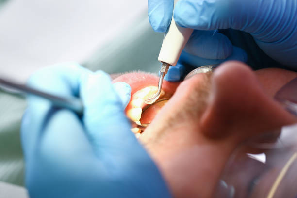 Best Dentist for Tooth Abscess  in Newton Falls, OH