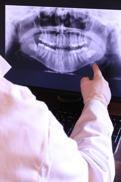 Best Root Canal Emergency Dentist  in Newton Falls, OH